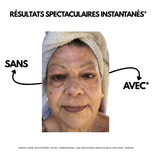 Instant Anti-Ride – Effet Lissant Immédiat & Visage Jeunesse - Allnove--Allnove-